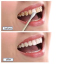 Blanchiment Des Dents LANBENA
