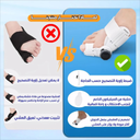 Correcteur Hallux avec Molette Réglable